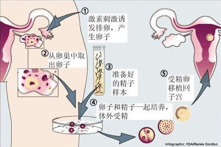 供卵代怀包生男孩机构